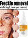 Kojic Acid Dark Spot Correcting Serum