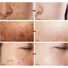 Kojic Acid Dark Spot Correcting Serum