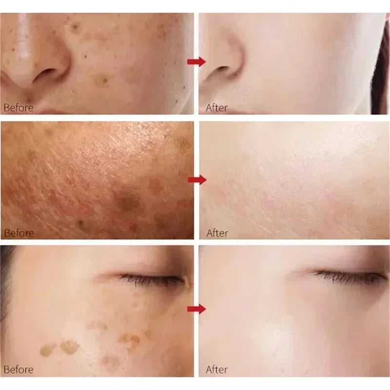 Kojic Acid Dark Spot Correcting Serum
