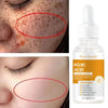 Kojic Acid Dark Spot Correcting Serum