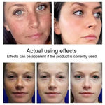Kojic Acid Dark Spot Correcting Serum