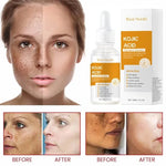 Kojic Acid Dark Spot Correcting Serum